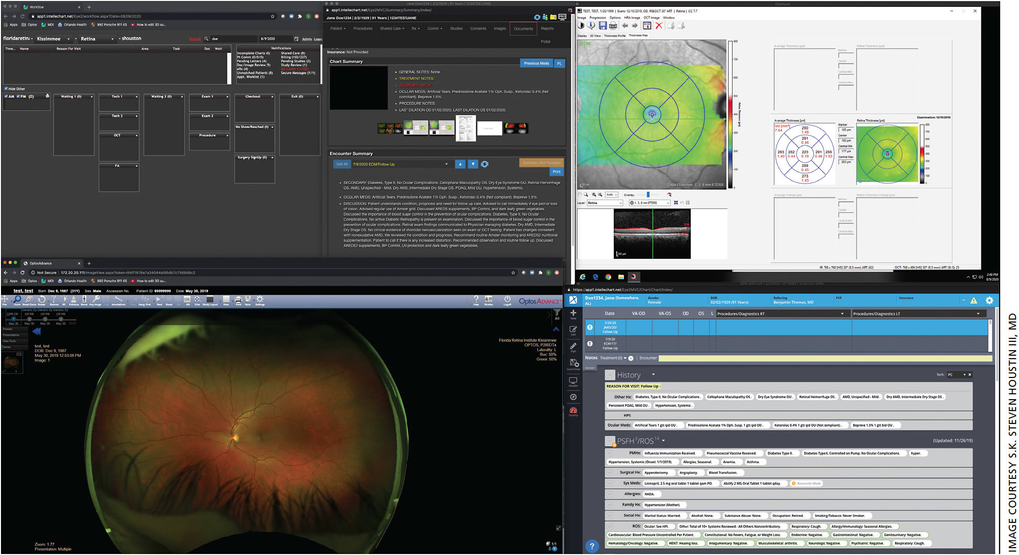 Figure. My monitor layout, either using one large monitor (&gt;28”) or two connected monitors. Information is displayed to enhance efficiency and allow me to assimilate the information rapidly. I can view the prior note, SD-OCT scans (Heidelberg Spectralis), UWF images (Optos) and the current history and patient data and make complex decisions within seconds prior to entering the room with a patient.
