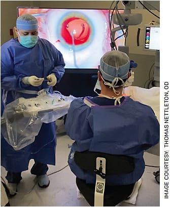 Heads-up display operating microscope technology enables better posture for the surgeon. The result is additional longevity to one’s surgical career, thanks to the reduction of the back and neck problems common in ophthalmologists.