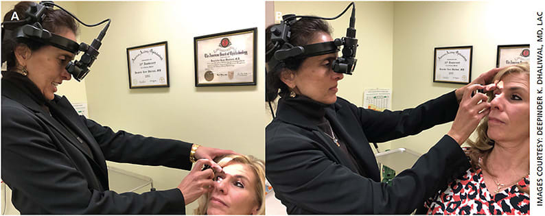 Figure. When examining a patient with an indirect ophthalmoscope, avoid flexing your neck forward (A). Instead, raise your patient’s chair so that it is closer to eye level to maintain good posture (B).