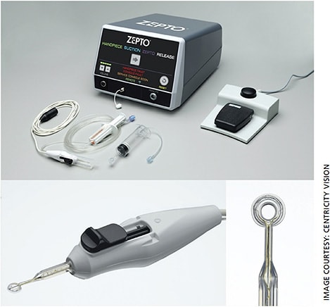 Figure 1. Top: The Zepto System, including console, handpiece and foot pedal. Bottom left: Close up of the Zepto disposable handpiece. Bottom right: Close up of the silicone sleeve and nitinol ring of the disposable handpiece.