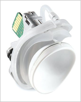 FIGURE 2. LipiFlow Activator II provides controlled therapeutic heat to the palpebral conjunctiva while protecting the cornea and globe. A multi-phased, peristaltic pressure sequence simultaneously unblocks and evacuates stagnant gland contents using proprietary technologies developed by TearScience. The Activator II contains redundant safety measures built into the device.