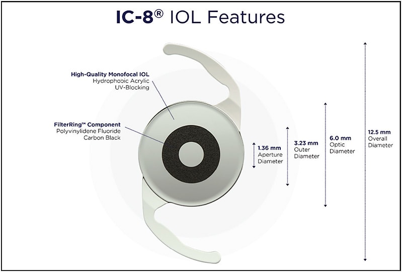AcuFocus Inc.’s IC-8 Small Aperture IOL