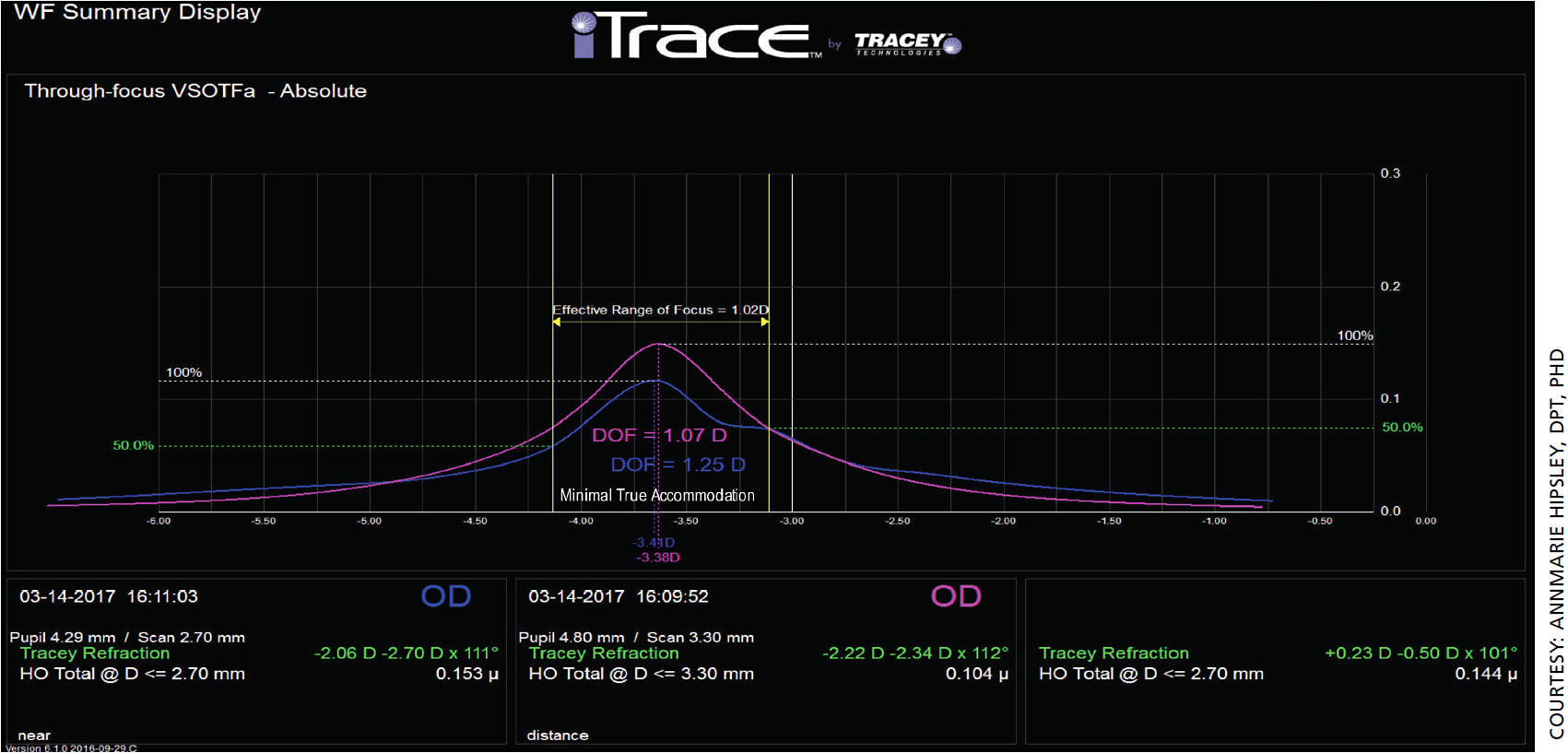 Figure 3. Representative figure of effective range of focus (EROF) for a presbyopic (59-year-old) eye. Visual Strehl ratio based upon the optical transfer function (VSOTF) is computed as a function of defocus using a through-focus curve. Through-focus curves are shown for distance (pink) and near (blue).