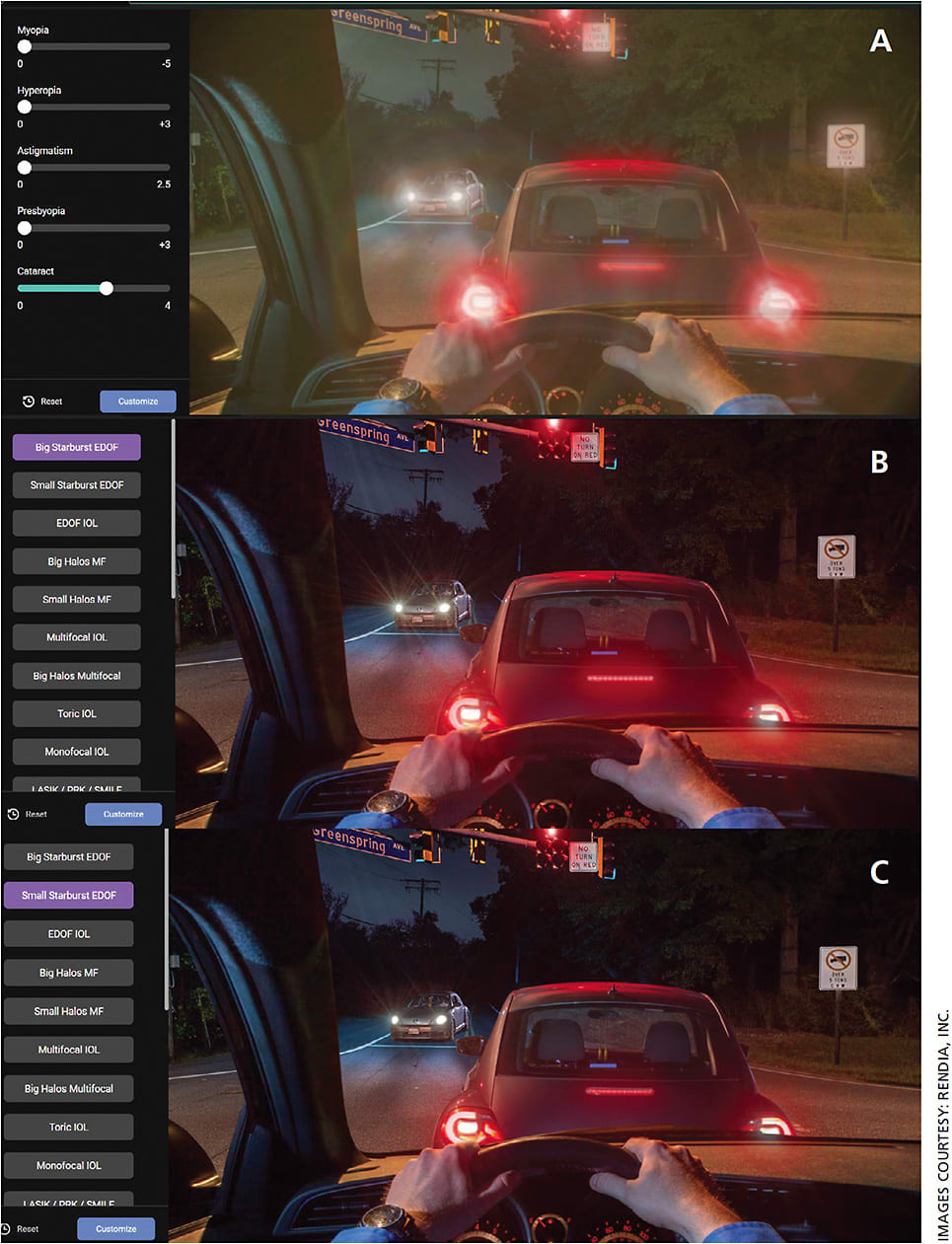 Figure 3. The Rendia Outcome Simulator allows the surgeon to customize the scene to fit various scenarios. A. Vision through cataract at night simulator. Glare and halos around headlights caused by cataracts. B. Large night-time starburst (EDOF IOL) simulator. Simulation of the large starbursts off of headlights that will occur immediately following EDOF IOL implantation. C. Small night-time starburst (EDOF IOL) simulator. After second eye EDOF surgery and neuro-adaptation, starbursts, while still present, are less apparent.