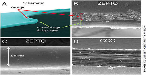 Figure 2. Electron microscopy showing the difference in edge roughness between the Zepto capsulotomy and the CCC.