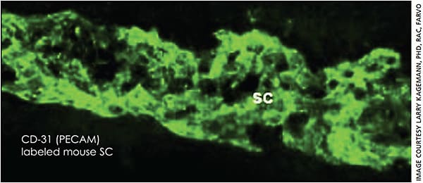 Figure 6. The nodular morphology of Schlemm’s canal observed in both resin and “virtual castings” is confirmed in an endothelial staining in a mouse eye.