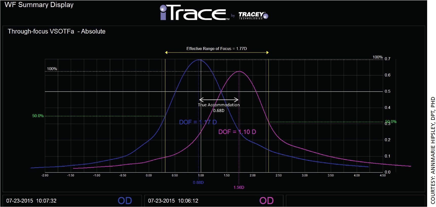 Figure 5. Representative figure of effective range of focus (EROF) for a patient eye after LaserACE. Visual Strehl ratio based upon the optical transfer function (VSOTF) is computed as a function of defocus using a through-focus curve. Through-focus curves are shown for distance (pink) and near (blue).