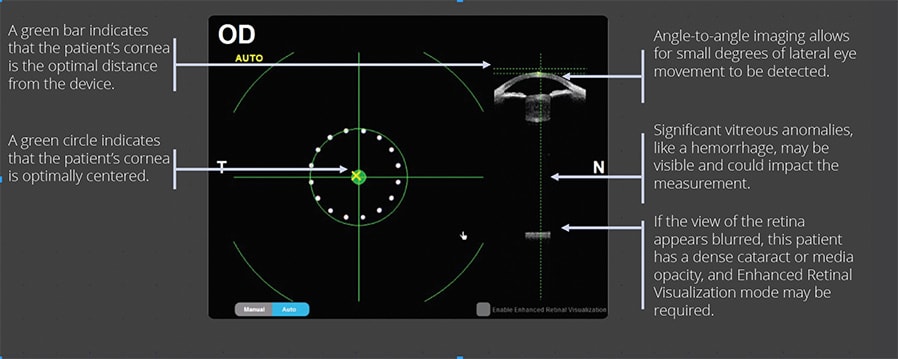 ARGOS image