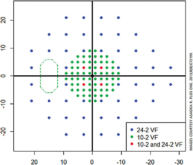 Figure 1: Mapping of 10-2 and 24-2 VF test points. Blue and green circles represent test points in the 24-2 VF and 10-2 VF, respectively. Red circles show points tested by both the 24-2 VF and 10-2 VF.15