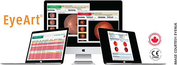 Figure 2. Eyenuk’s EyeArt AI Eye Screening System for DR