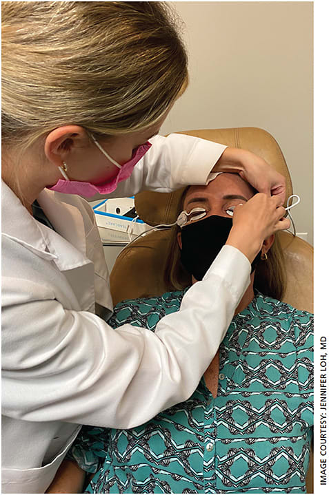 Joanna Cotter, OD, uses the TearCare (Sight Sciences) device on a patient.