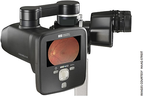 Close-up view of the compact Haag-Streit Fundus Module 300.