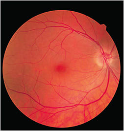 FIGURE 2. Example of color fundus photo of a healthy eye.