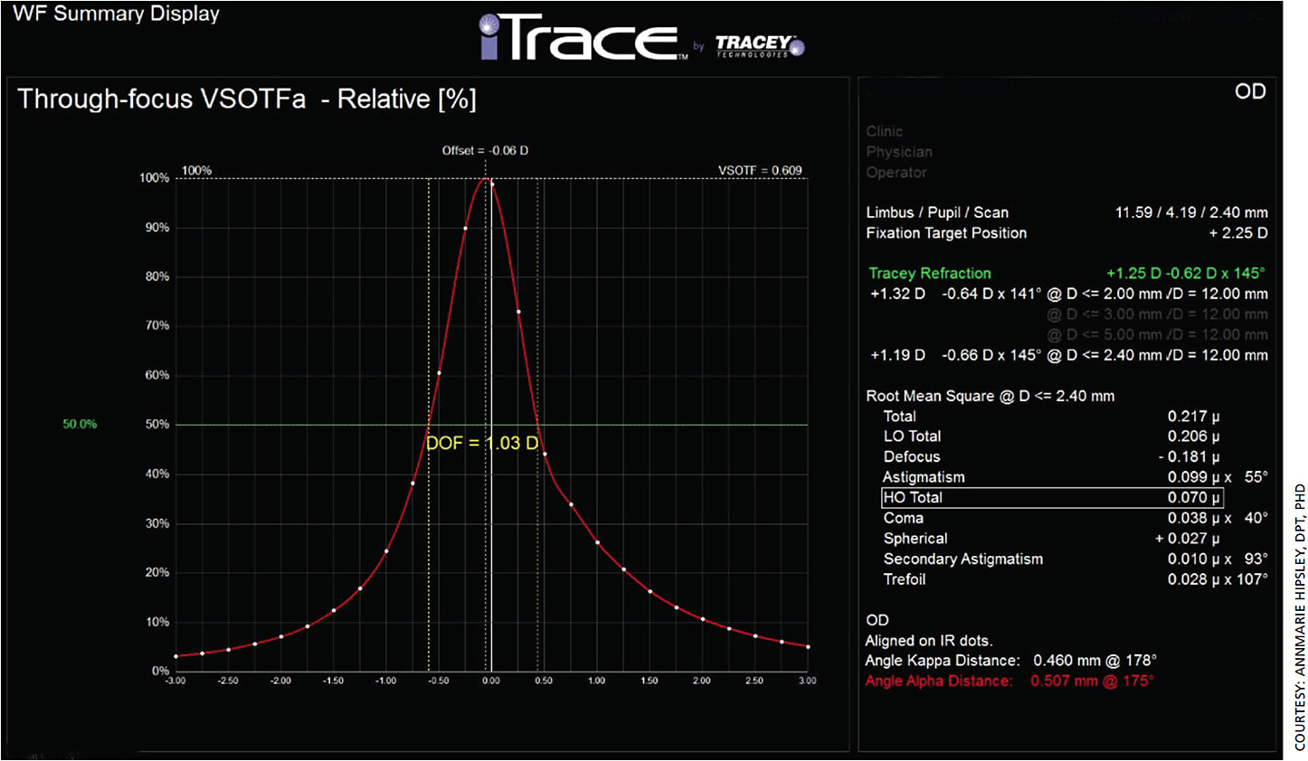 Figure 1. Depth of focus (DoF). Visual Strehl ratio is based upon the optical transfer function (VSOTF) and is computed as a function of defocus using a through-focus curve.