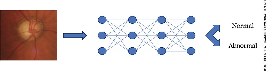 FIGURE. Schematic demonstrating the application of a multi-layer machine learning approach to classification of an optic nerve as normal or abnormal.