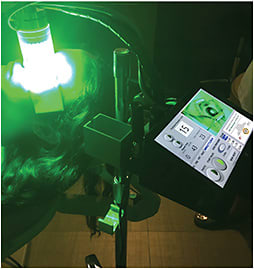 FIGURE 3. RB-PDAT with computer-controlled 525 nm light-emitting diodes console. This photo demonstrates the actual procedure during the green light phase.