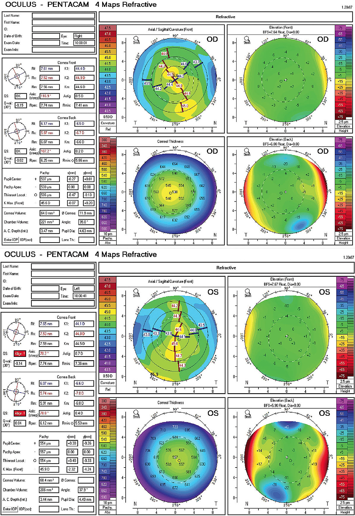 Figure 2. Two weeks after dry eye therapy was initiated.