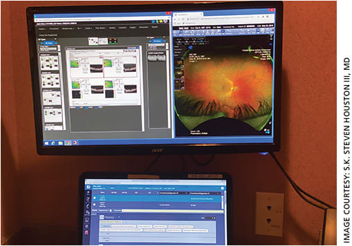 Figure. Review station showing laptop (bottom) with EHR information and large monitor (above) displaying OCT comparisons (left) and Optos UWF software (right).