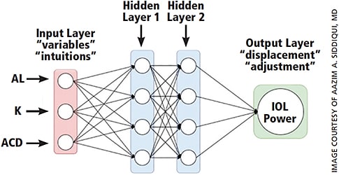 Figure 3. Schema of Ladas super formula AI.