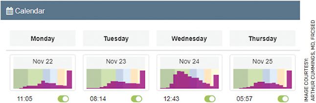 FIGURE 2. Four days of data collected for four defocus curves. Graphs show the 4 different defocus curves collected over 4 days, the subtle differences between them and the fact that you can include/exclude any of them.