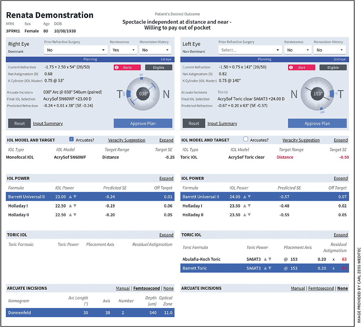 A screenshot of Veracity, a Web-based program for compiling IOL data from EMRs, biometry and diagnostic systems.