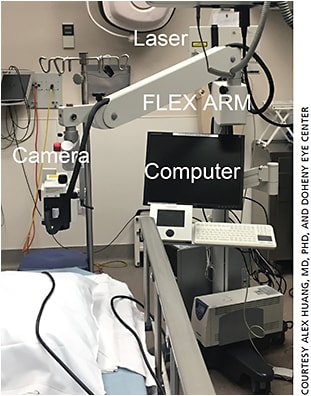 Figure 1. Heidelberg’s Spectralis FLEX module arranges the Spectralis so that imaging (optical coherence tomography or angiography) can be performed in a supine position in the operating room. The FLEX is still under development.