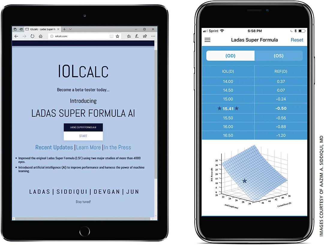 Figure 4. How IOLcalc.com appears when downloaded on iPhone and Android.