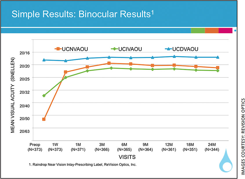 Figure 2. 24M post-operative, on average patients, are 20/25 or better at all distances binocularly; +5 line improvement in near, +2.5 lines for intermediate. No change in distance.