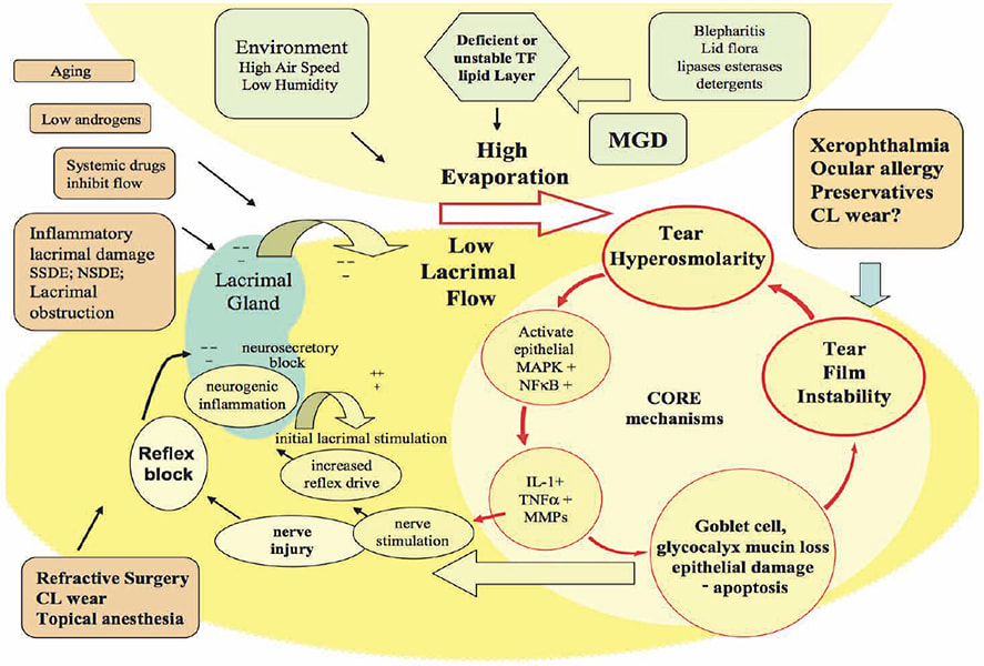 Figure 1. Inflammation drives and results from aqueous-deficient dry eye and evaporative dry eye in a chronic downward cycle.1