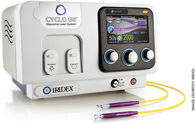 Figure 4. Iridex Cyclo G6 Glaucoma Laser System