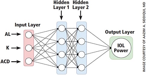 Figure 2. Schema of AI-integrated IOL formula.