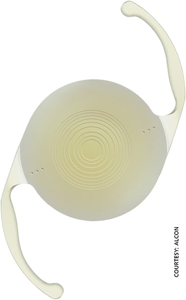 Alcon&#8217;s IQ ReSTOR multifocal toric IOL