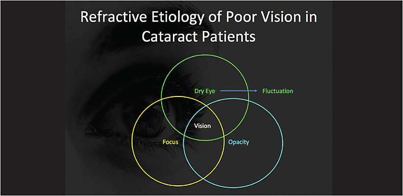 Figure 1. Refractive etiology of poor vision in cataract patients: the holistic view.