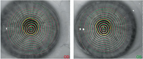 Figure 2 Image courtesy of Dr. Resnick.