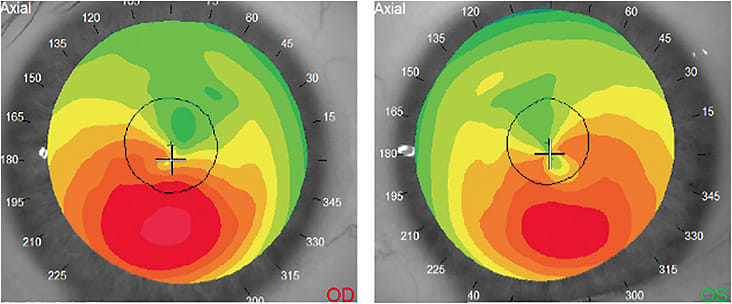 Figure 1 Image courtesy of Dr. Resnick.