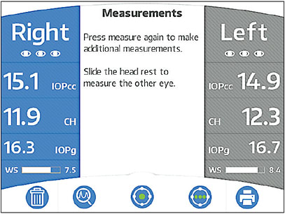 Average CH in normal eyes in the United States is 10.5mmHg.
Courtesy of Diopsys.