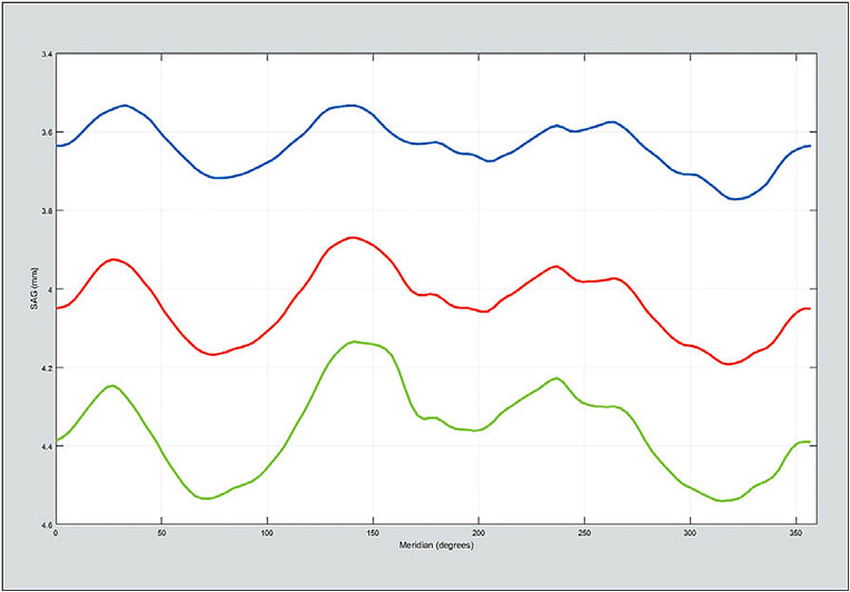 Figure 4: Non-toric asymmetric sagittal height plot from Figure 3 elevation map