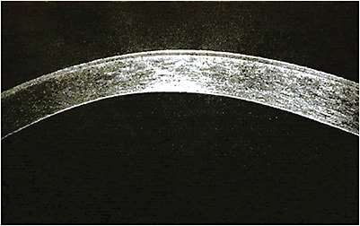 Pachymetry demonstrates thin zones within the cornea, information useful in fitting sclerals.
Courtesy of Jason Miller, O.D.