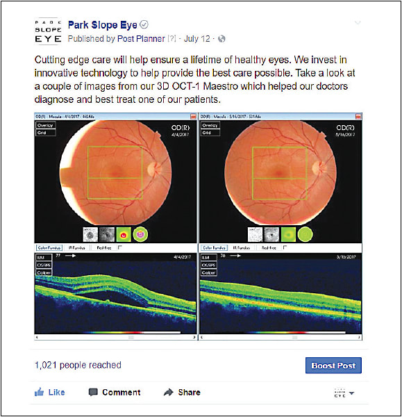Park Slope Eye uses a basic Facebook post to market its tech.
Courtesy of Park Slope Eye