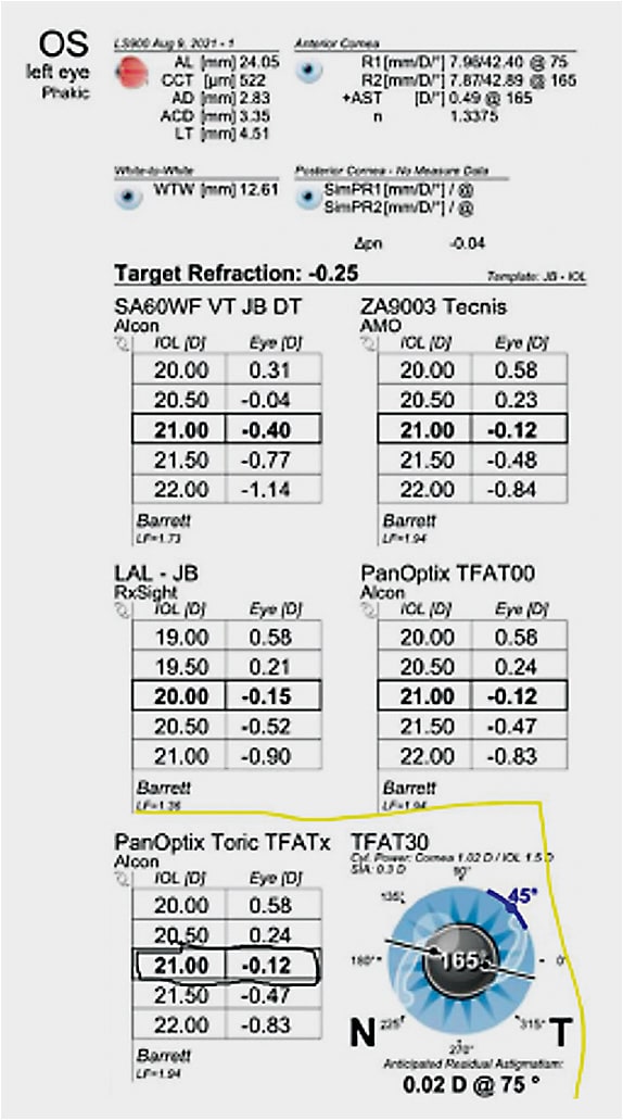 Figure 3. Lenstar Biometry for OS. Gives a predicted lens power for OS.