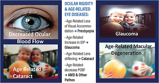 Figure 4. Ocular diseases associated with elevated ocular rigidity.