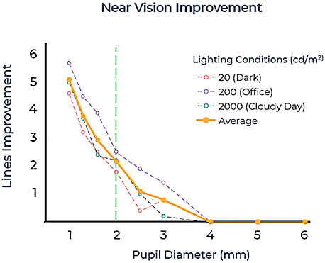Figure 2. Near vision improvement of the eye as a function of pupil diameter. From: Xu R, Thibos L, Bradley A. Effect of Target Luminance on Optimum Pupil Diameter for Presbyopic Eyes. Optom Vis Sci. 2016 Nov;93(11):1409-1419.