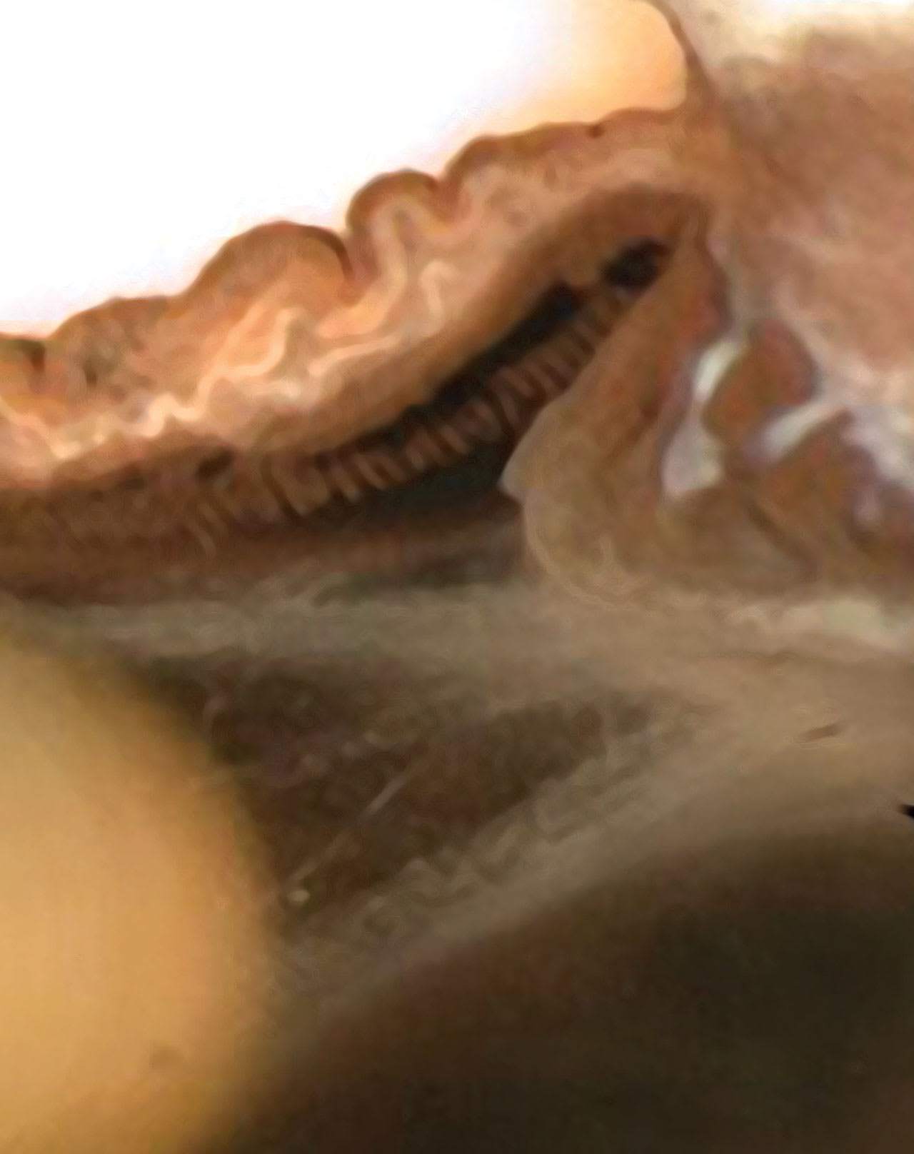 Figure 1. Anterior insertion of zonules in a human cadaver eye.
