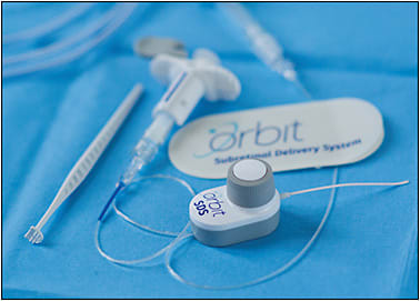 Figure 3. The Orbit SDS device by Novartis (formerly Gyroscope Therapeutics).