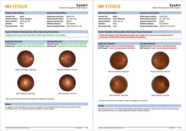 Figure 5. The EyeArt AI Eye Screening System by Eyenuk is cleared by the FDA for detection of both more than mild diabetic retinopathy and vision-threatening diabetic retinopathy and is cleared for use with multiple camera models.