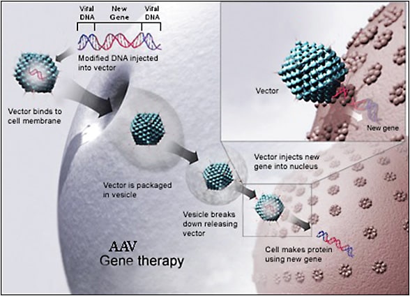 Figure 3. Adeno-associated virus (AAV) gene therapy. From https://commons.wikimedia.org/wiki/File:Antisense_DNA_oligonucleotide.png . Licensed for reuse.