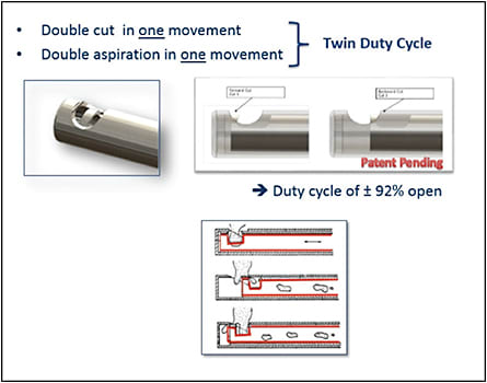 Figure 5. Key features of the DORC twin-duty cycle 27-gauge vitrector.