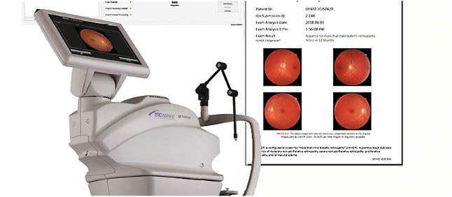 Figure 4. LumineticsCore (formerly known as IDx-DR) by Digital Diagnostics is indicated for detection of the presence of more than mild diabetic retinopathy.