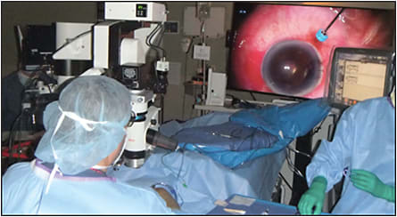 Figure 1. Current OR configuration for high-resolution 3D digital surgical viewing.