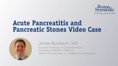 Acute Pancreatitis and Pancreatic Stones Case